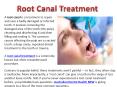 Root Canal Treatment PowerPoint PPT Presentation