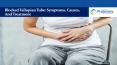 Blocked Fallopian Tube: Symptoms, Causes, And Treatment PowerPoint PPT Presentation