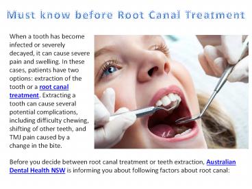 Must know before Root Canal Treatment