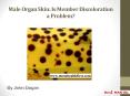 Male Organ Skin: Is Member Discoloration a Problem? PowerPoint PPT Presentation
