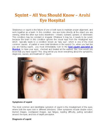 Squint – All You Should Know - Arohi Eye Hospital