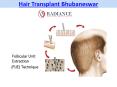 Hair Transplant Bhubaneswar PowerPoint PPT Presentation