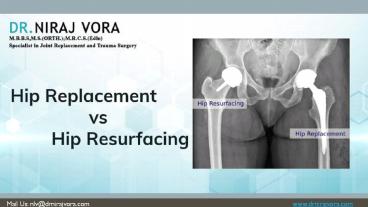 Total Hip Replacement vs Hip Resurfacing