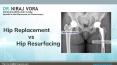 Total Hip Replacement vs Hip Resurfacing PowerPoint PPT Presentation