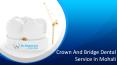 Best Crown and Bridge Dental Service in Mohali PowerPoint PPT Presentation