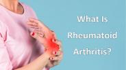 What is Rheumatoid Arthritis? PowerPoint PPT Presentation