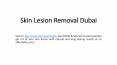 Skin Lesion Removal Dubai PowerPoint PPT Presentation
