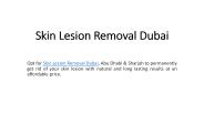 Skin Lesion Removal Dubai