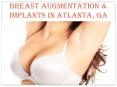 BREAST AUGMENTATION & IMPLANTS IN ATLANTA, GA PowerPoint PPT Presentation