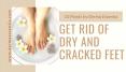 How to Get Rid of Dry and Cracked Feet? PowerPoint PPT Presentation