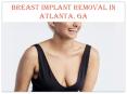 BREAST IMPLANT REMOVAL IN ATLANTA, GA PowerPoint PPT Presentation