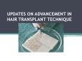 UPDATES ON ADVANCEMENT IN HAIR TRANSPLANT TECHNIQUE PowerPoint PPT Presentation