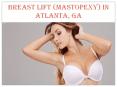 BREAST LIFT (MASTOPEXY) IN ATLANTA, GA PowerPoint PPT Presentation