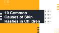 10 Common Causes of Skin Rashes in Children PowerPoint PPT Presentation
