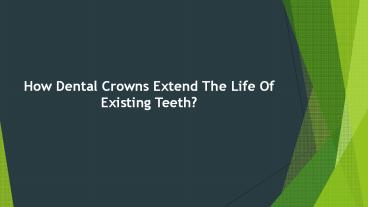How Dental Crowns Extend The Life Of Existing Teeth?