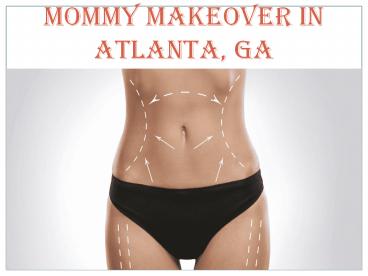 MOMMY MAKEOVER IN ATLANTA, GA