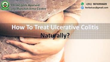 Herbal Treatment for Ulcerative Colitis