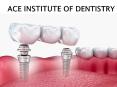 Rotary Endodontics Course And Dental Implant Courses in India PowerPoint PPT Presentation