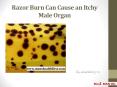 Razor Burn Can Cause an Itchy Male Organ PowerPoint PPT Presentation