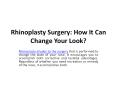Rhinoplasty Surgery: How It Can Change Your Look? PowerPoint PPT Presentation