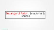 What are the symptoms & Causes of Tetralogy of Fallot