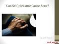 Can Self-pleasure Cause Acne? PowerPoint PPT Presentation