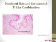 Manhood Skin and Cortisone: A Tricky Combination PowerPoint PPT Presentation