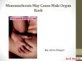 Mononucleosis May Cause Male Organ Rash PowerPoint PPT Presentation