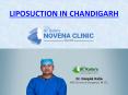 Liposuction in Chandigarh (3) PowerPoint PPT Presentation