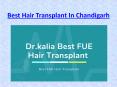 Best Hair Transplant In Chandigarh PowerPoint PPT Presentation