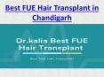 Best FUE Hair Transplant in Chandigarh PowerPoint PPT Presentation