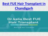 Best FUE Hair Transplant in Chandigarh