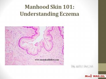 Manhood Skin 101: Understanding Eczema