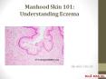 Manhood Skin 101: Understanding Eczema PowerPoint PPT Presentation