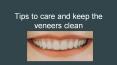 Tips to care and keep the veneers clean PowerPoint PPT Presentation