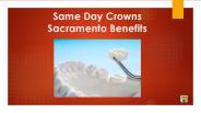 Same Day Crowns Sacramento