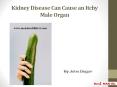 Kidney Disease Can Cause an Itchy Male Organ PowerPoint PPT Presentation
