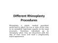 Different Rhinoplasty Procedures PowerPoint PPT Presentation