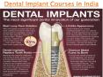 Dental Implant And Dental Implantology Courses in India By ACE INSTITUTE OF DENTISTRY (1) PowerPoint PPT Presentation