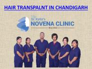 Hair Transplant In Chandigarh