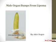 Male Organ Bumps From Lipoma