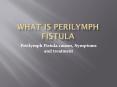 What is Perilymph Fistula? PowerPoint PPT Presentation