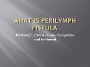 What is Perilymph Fistula?