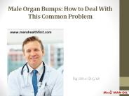 Male Organ Bumps: How to Deal With This Common Problem