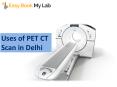 PET CT Scan in Delhi NCR, PET CT Scan Cost in Delhi PowerPoint PPT Presentation