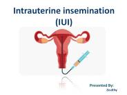 आईयुआई क्या है ? | What is Intrauterine Insemination?