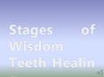 Stages of Wisdom Teeth Healing PowerPoint PPT Presentation
