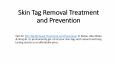 Skin Tags Removal Treatment and Prevention PowerPoint PPT Presentation