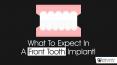 What To Expect In A Front Tooth Implant PowerPoint PPT Presentation