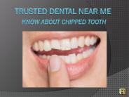 Trusted Dental Near Me - Know about Chipped Tooth